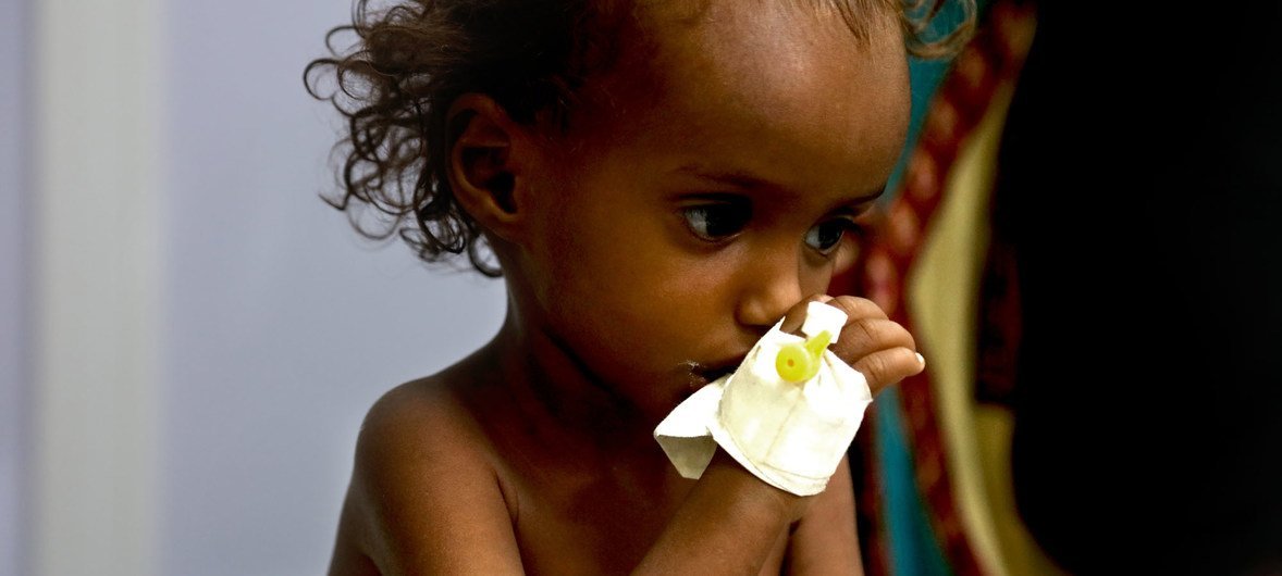 Des millions d'enfants au Yémen son confrontés à la malnutrition en raison du conflit.