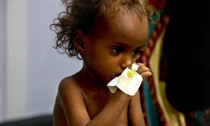 Millions of children across Yemen face serious threats due to malnutrition, in particular, and the lack of basic health services, in general -- all caused by the country's hostilities and ongoing war. (October 2018)