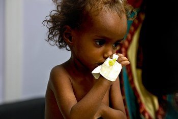 Des millions d'enfants au Yémen son confrontés à la malnutrition en raison du conflit.