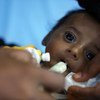 Bebê de quatro meses do Iêmem que sofre de subnutrição