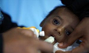 This baby boy weighed 2.5 kg when he was born in Yemen. Now at four months old he suffers from severe acute malnutrition. (file)