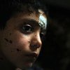 Traveling with his family via an unofficial border crossing from Syria to Lebanon, the nine-year-old boy pictured here was injured during an unidentified explosion; abrasions from the explosion are also visible on his face.