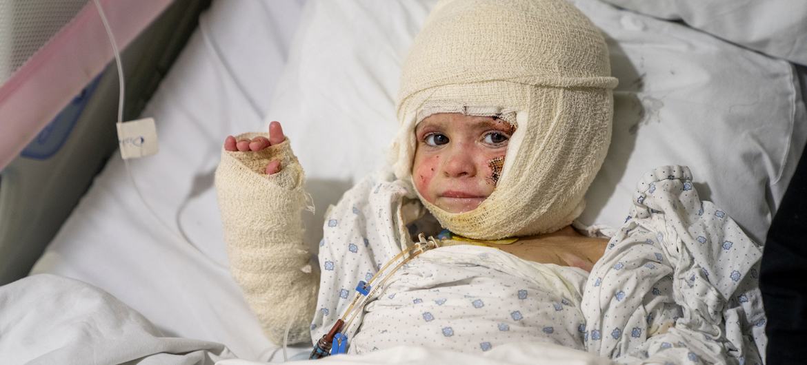 © UNICEF/Fouad Choufany A two-year-old from Tyre, Lebanon, recovers from severe burns following an Israeli airstrike.