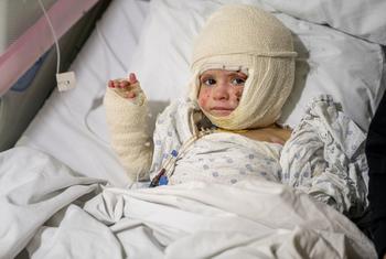 A two-year-old from Tyre, Lebanon, recovers from severe burns following an Israeli airstrike.