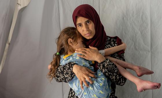 تم نقل طفلة تبلغ من العمر سبع سنوات تعاني من سوء التغذية الحاد الشديد والجفاف إلى مستشفى ميداني في جنوب غزة في أبريل/نيسان وسط مجاعة تلوح في الأفق في الشمال.