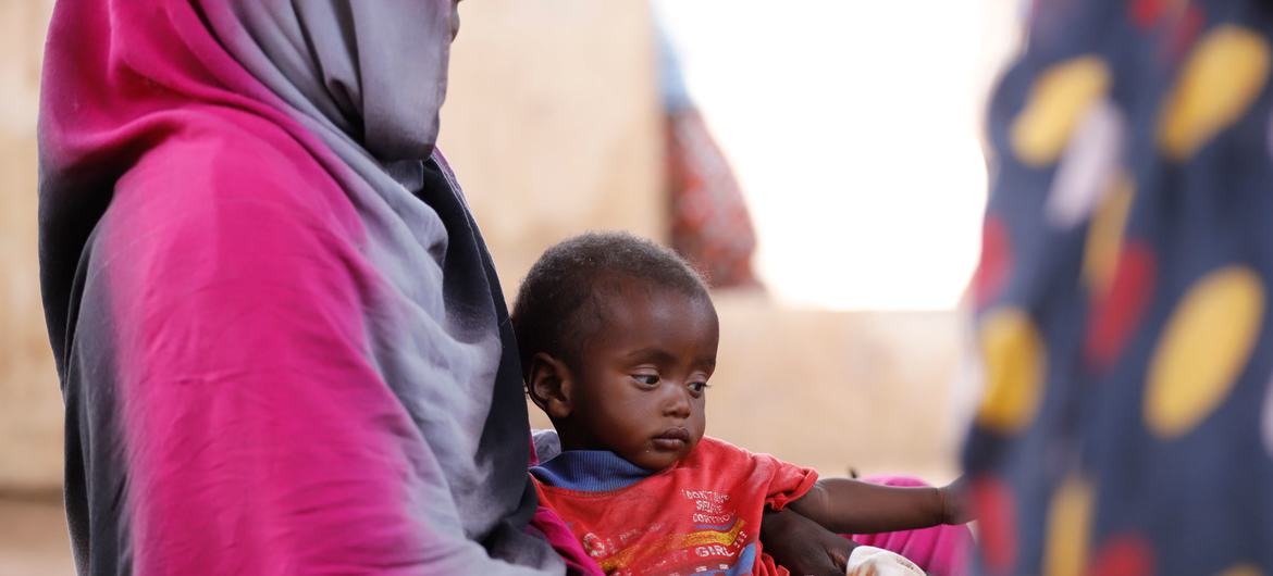 Un niño es examinado por desnutrición en una clínica de Tawila, Darfur del Norte.