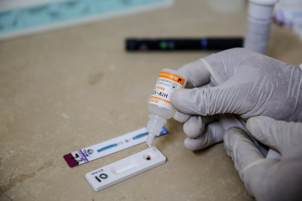 Un técnico de laboratorio realiza una prueba de detección del VIH en un centro médico de Hayatabad, en el distrito de Peshawar (Pakistán).