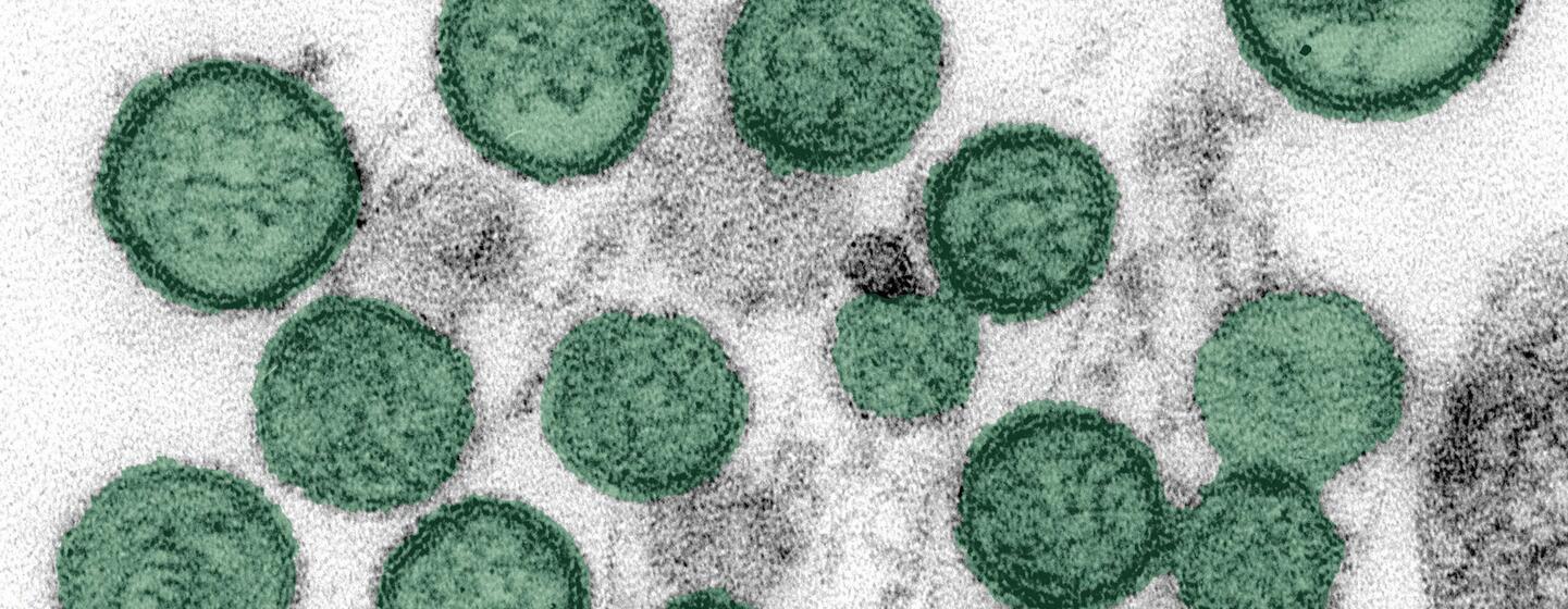 Image microscopique de particules du virus Hantavirus de couleur verte sur fond blanc.