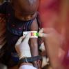 在苏丹的杰济拉州，一名儿童正在接受营养不良筛查。