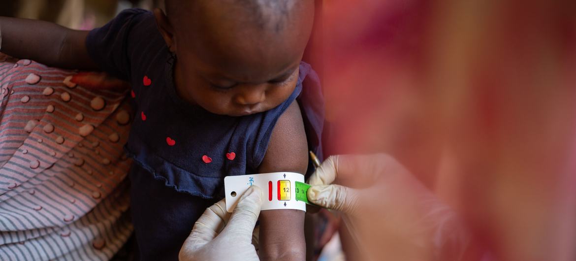 Un niño es examinado para detectar desnutrición en el estado de Gezira, en Sudán.