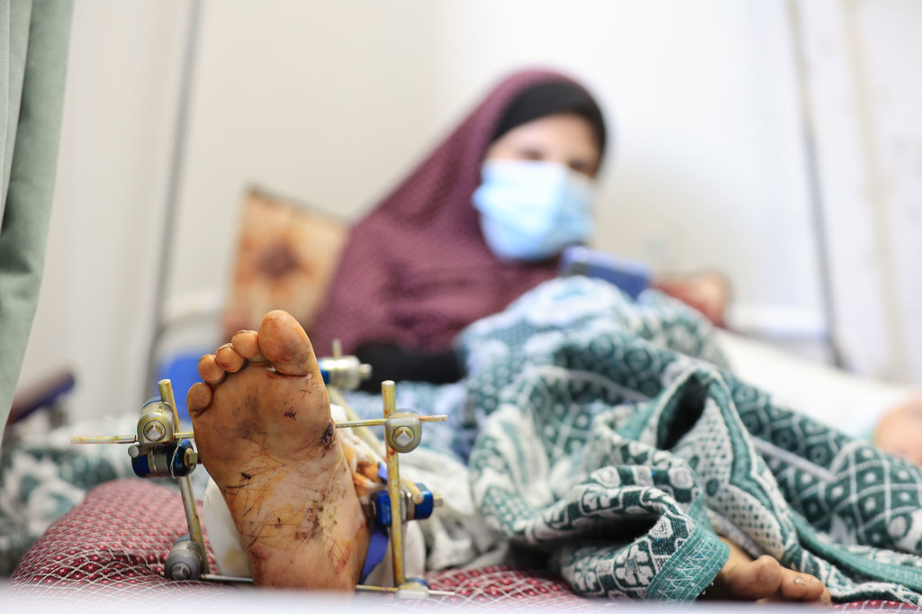 A woman recovers in Al Hilo Hospital in Gaza City after being buried in rubble and having an emergency  cesarean section. 