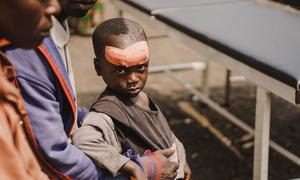 A young boy was injured while fleeing clashes at a site for displaced people in North Kivu province in the eastern Democratic Republic of the Congo.