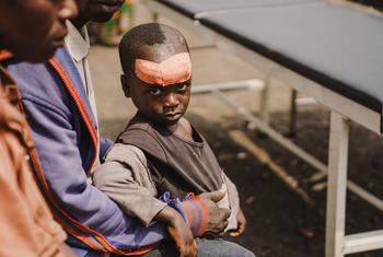 A young boy was injured while fleeing clashes at a site for displaced people in North Kivu province in the eastern Democratic Republic of the Congo.
