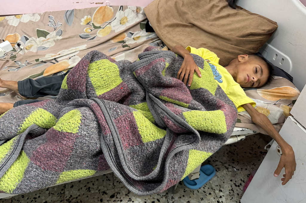 Un niño palestino yace en una cama de hospital en el Hospital Nasser de Khan Younis, en la Franja de Gaza, sufriendo de desnutrición aguda grave.