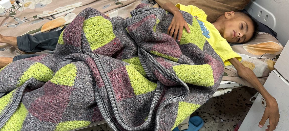 Um menino com desnutrição grave descansa em um hospital em Gaza