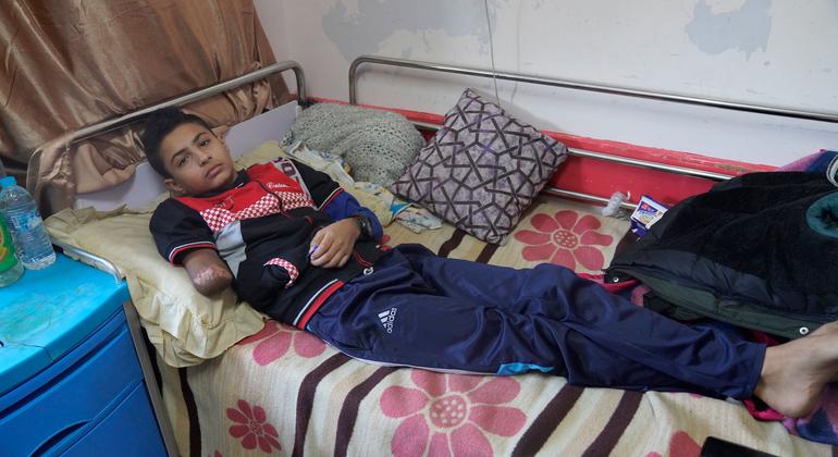 A 13-year-old boy recovers at Nasser Hospital in Khan Younis, Gaza Strip after his crushed and gangrenous lower arm was amputated.