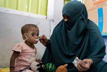 A child diagnosed with severe acute malnutrition is fed ready-to-use therapeutic food by her mother at a refugee nutrition facility in Cox's Bazar, Bangladesh.