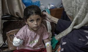 Una niña de ocho años sufrió la amputación de un brazo después de que su escuela fuera blanco de un ataque aéreo en Gaza.