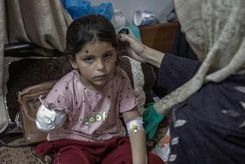 طفلة فلسطينية في الثامنة من العمر، تفقد ذراعها بعد قصف المدرسة التي كانت تقيم بها والتي تحولت إلى مركز لإيواء النازحين