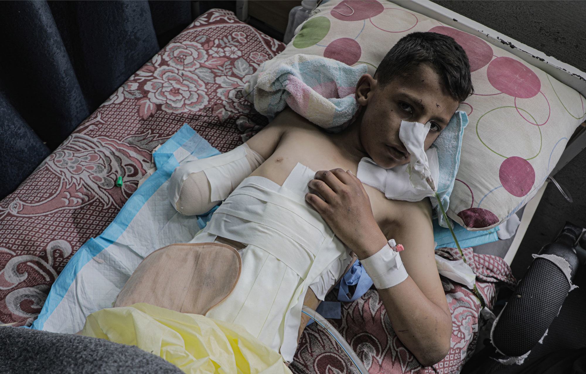 A boy receives medical care after being caught in a missile attack in Gaza. A boy receives medical care after being caught in a missile attack in Gaza.