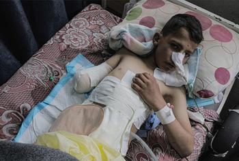 Un niño recibe atención médica tras quedar atrapado en un ataque con misiles en Gaza (mayo de 2025).