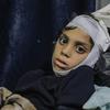 A boy recovers after being caught in an attack in Al Zaytoon neighbourhood of the Gaza City.