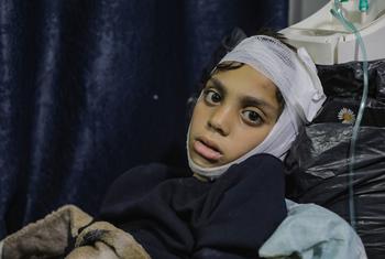 Un niño se recupera tras haber sido víctima de un ataque en el barrio de Al Zaytoon, en la ciudad de Gaza. Un niño se recupera tras haber sido víctima de un ataque en el barrio de Al Zaytoon, en la ciudad de Gaza.