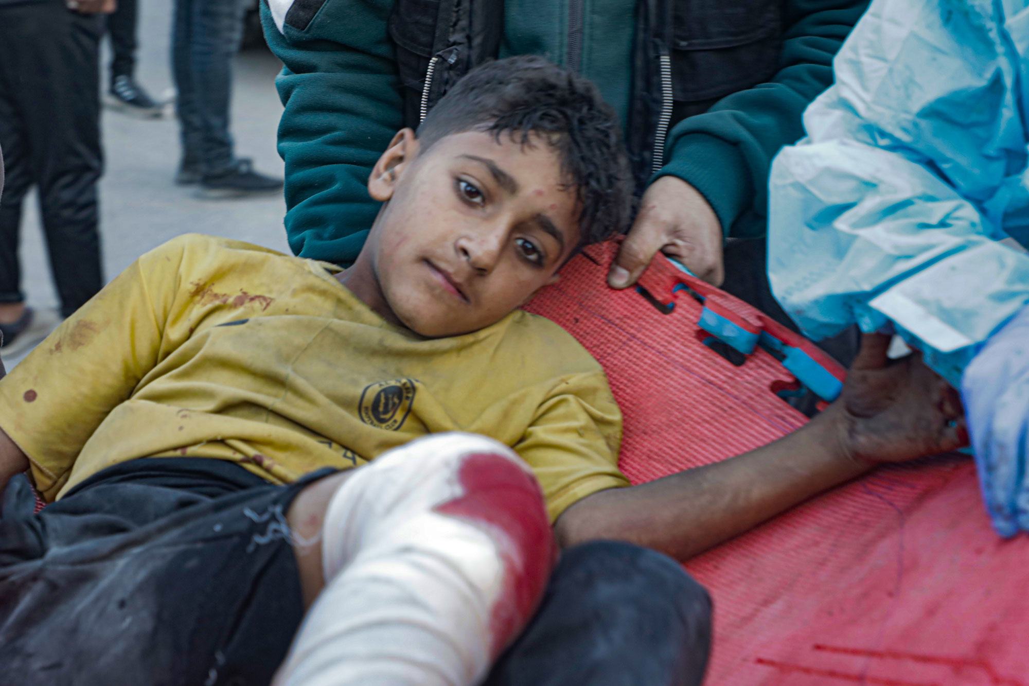 Un garçon est transporté à l’hôpital Al-Ma’amdani à Gaza, après une attaque contre un abri dans une école.