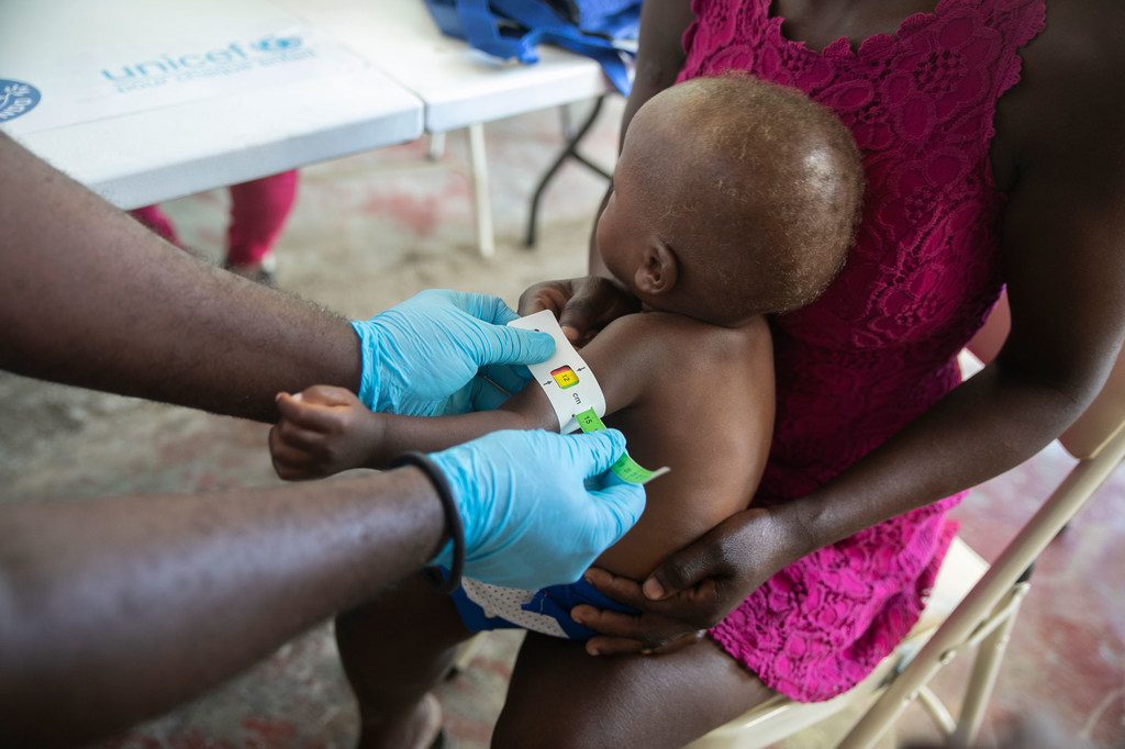 Le bras d'un enfant est mesuré pour déterminer la malnutrition dans une clinique gérée par l'UNICEF, à Cité Soleil, en Haïti.