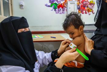 Dépistage d'un nourrisson pour malnutrition dans une clinique au Yémen.
