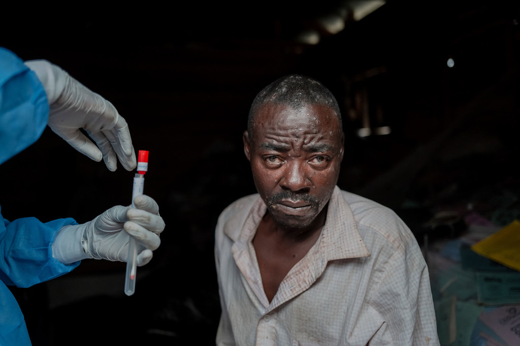 Un homme de l'est de la République démocratique du Congo subit une prise de sang dans le cadre de son traitement contre le mpox.