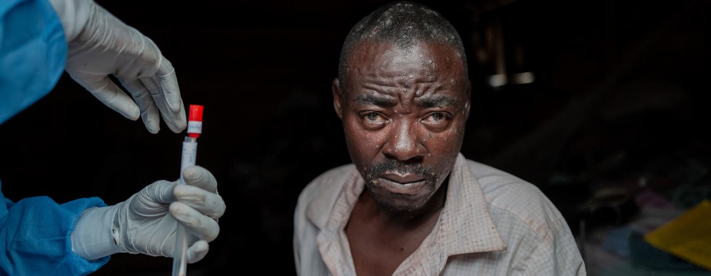 Un homme de l'est de la République démocratique du Congo subit une prise de sang dans le cadre de son traitement contre le mpox.