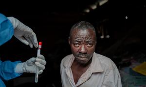 A man in eastern Democratic Republic of the Congo has his blood drawn as part of his treatment for mpox.