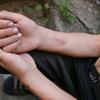 Hands of an injecting drug user in Odesa, southern Ukraine. (file)