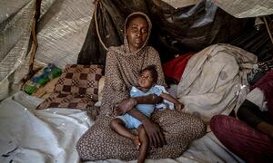 Halima, 30, holds her six-month-old daughter Samira, who has Down syndrome and was recently treated for malnutrition, inside a tent in a displacement camp in Tawila, North Darfur, Sudan.