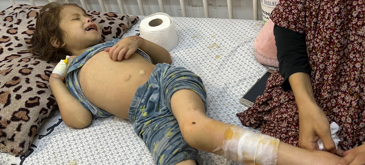 Seven-year-old Janah,is treated at Gaza City's Patient Friendly Hospital. Seven-year-old Janah,is treated at Gaza City's Patient Friendly Hospital.