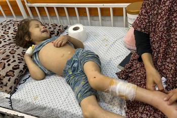 Семилетняя Джана проходит лечение от недоедания в больнице Patient Friendly Hospital в городе Газа.