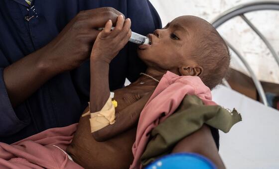 Трехлетняя девочка проходит лечение от недоедания в больнице в городе Тавила, Судан.