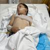 Un niño recibe tratamiento en el hospital tras un ataque en Deir Al-Balah, Gaza.