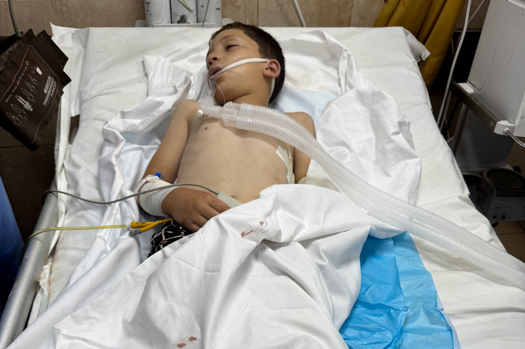 Un niño recibe tratamiento en el hospital tras un ataque en Deir Al-Balah, Gaza.