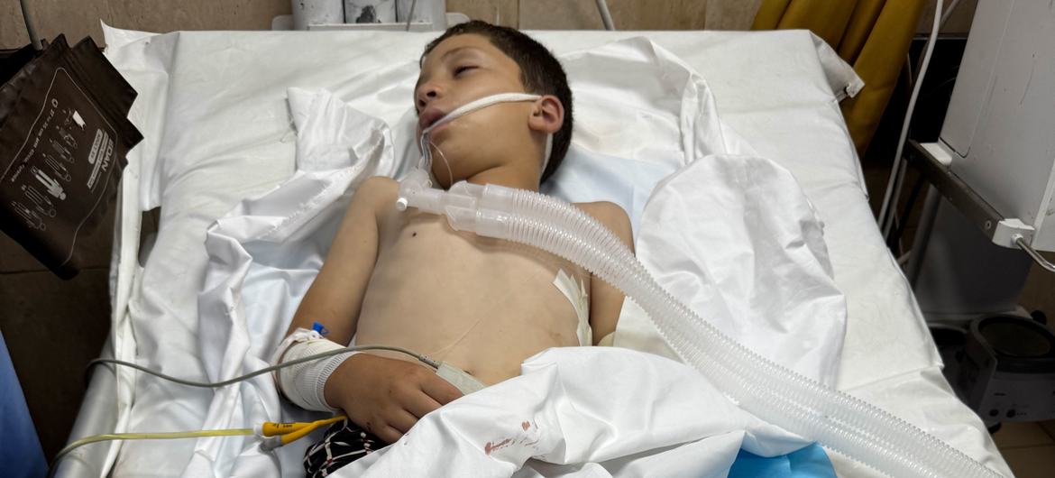 Un niño recibe tratamiento en el hospital tras un ataque en Deir Al-Balah, Gaza.