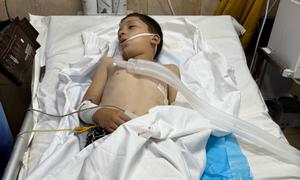 Un niño recibe tratamiento en el hospital tras un ataque en Deir Al-Balah, Gaza.