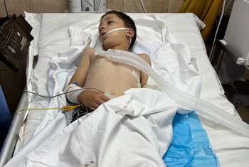 Un niño recibe tratamiento en el hospital tras un ataque en Deir Al-Balah, Gaza.