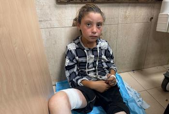 Une fille reçoit des soins hospitaliers après une attaque dans un point de nutrition à Deir Al-Balah, à Gaza.