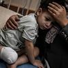 Les médecins ont décidé d'amputer le pied d'un enfant de trois ans à Khan Yunis, dans la bande de Gaza, en raison de ressources médicales limitées.
