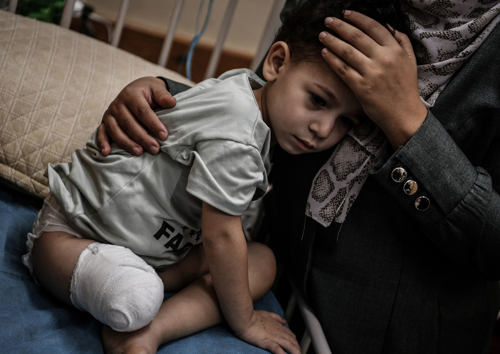 Les médecins ont décidé d'amputer le pied d'un enfant de trois ans à Khan Yunis, dans la bande de Gaza, en raison de ressources médicales limitées.