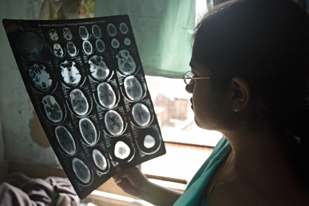 A doctor in Agra, India, examines the brain scan images of a patient.