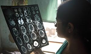 A doctor in Agra, India, examines the brain scan images of a patient.