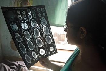 Un doctor examina las imágienes del cerebro de un paciente en Agra, India. Un doctor examina las imágienes del cerebro de un paciente en Agra, India.