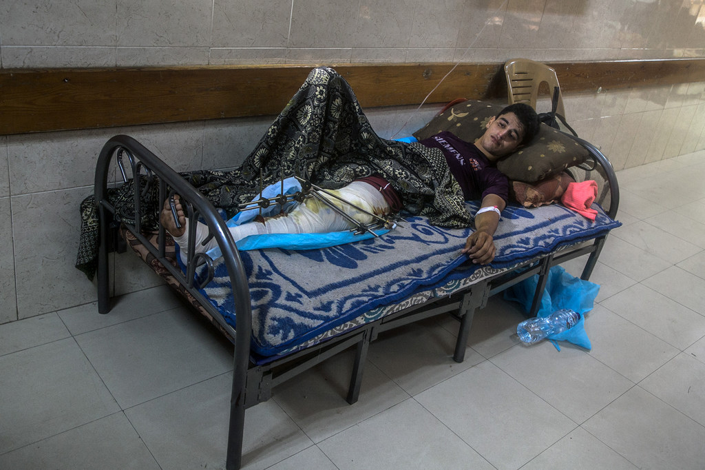 Un adolescent reçoit un traitement dans un hôpital de Gaza.